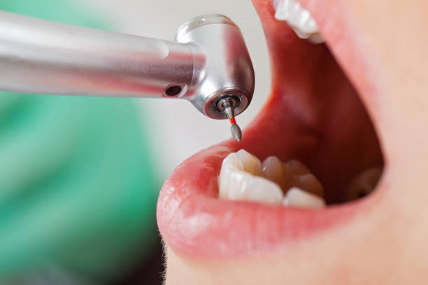 Best Urgent Care for Lost Fillings or Crowns in Indian River, MI